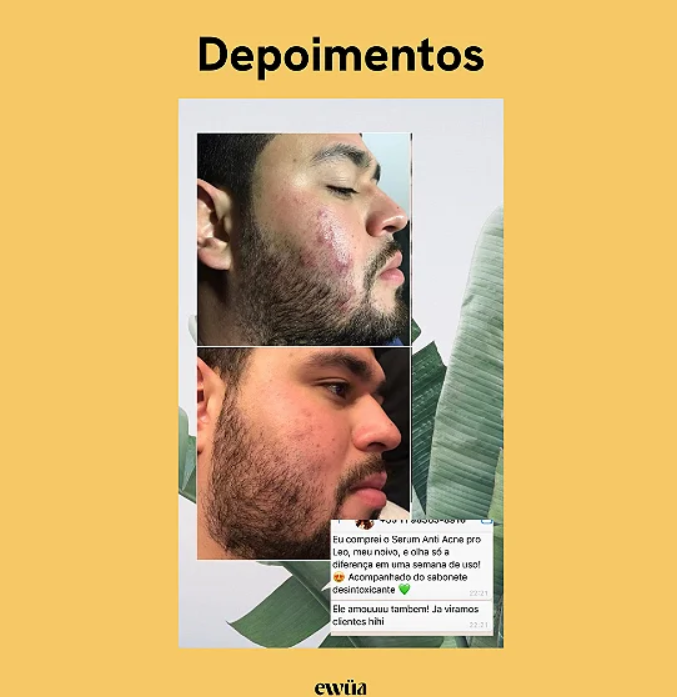 Kit Peles Mistas e Oleosas